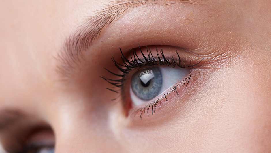 Laser for Under Eye Wrinkles
