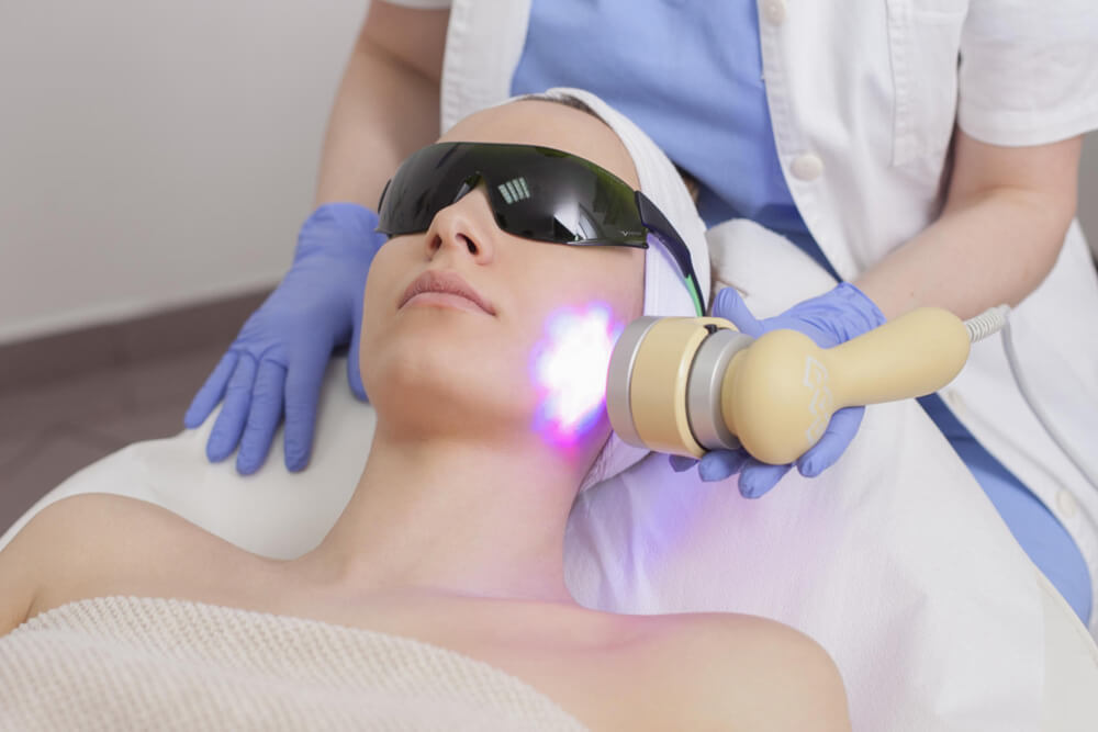 IPL Laser Treatment